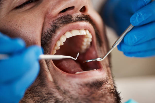 Best Emergency TMJ Treatment in Carlinvle, IL