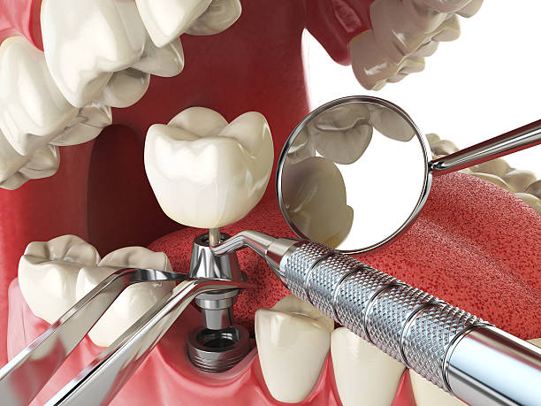  Carlinvle, IL Emergency Dentist Pros